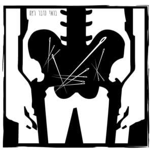 36 – אלברט פיש